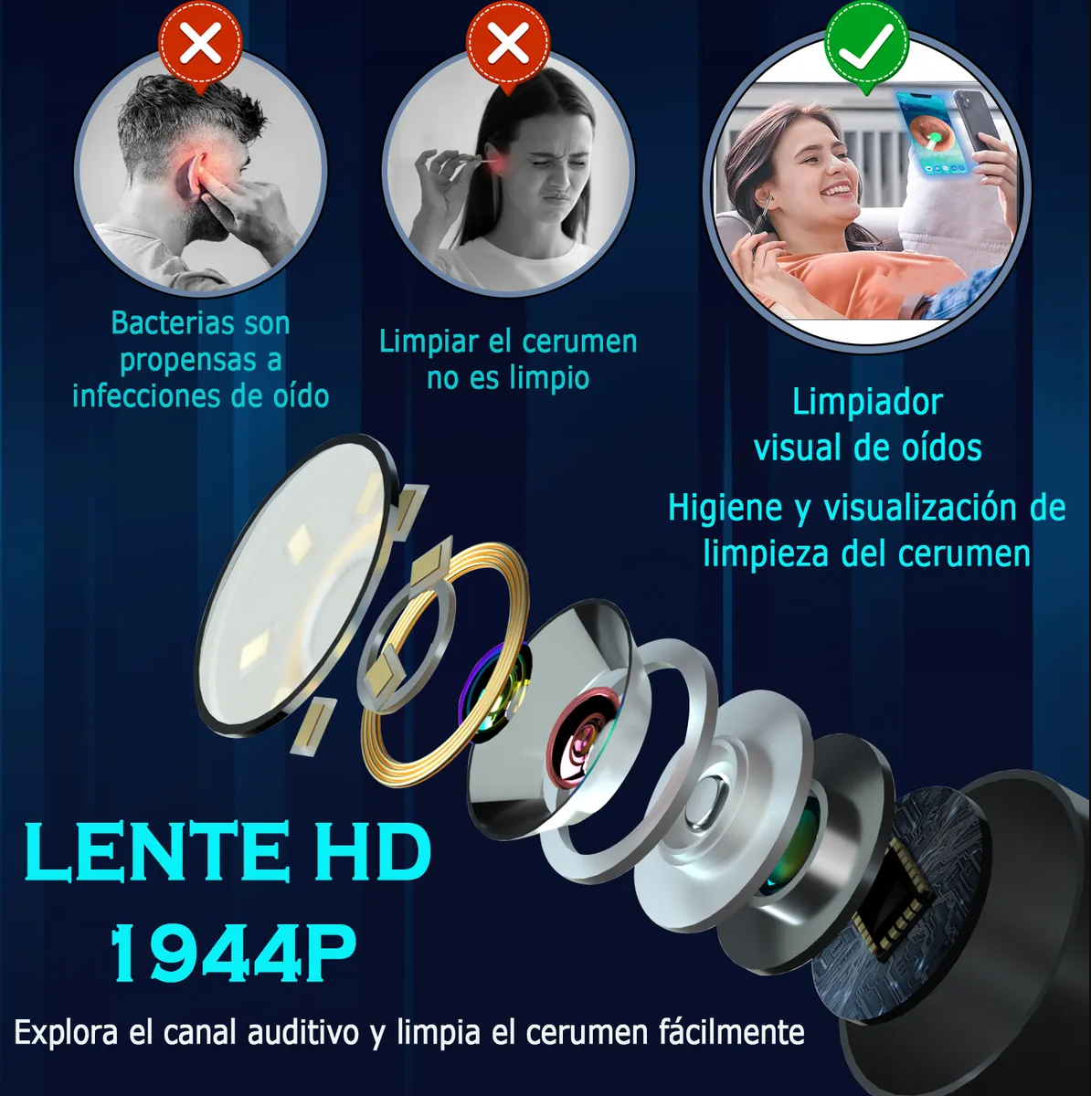 IClean Max – Limpiador de oídos inteligente con cámara HD